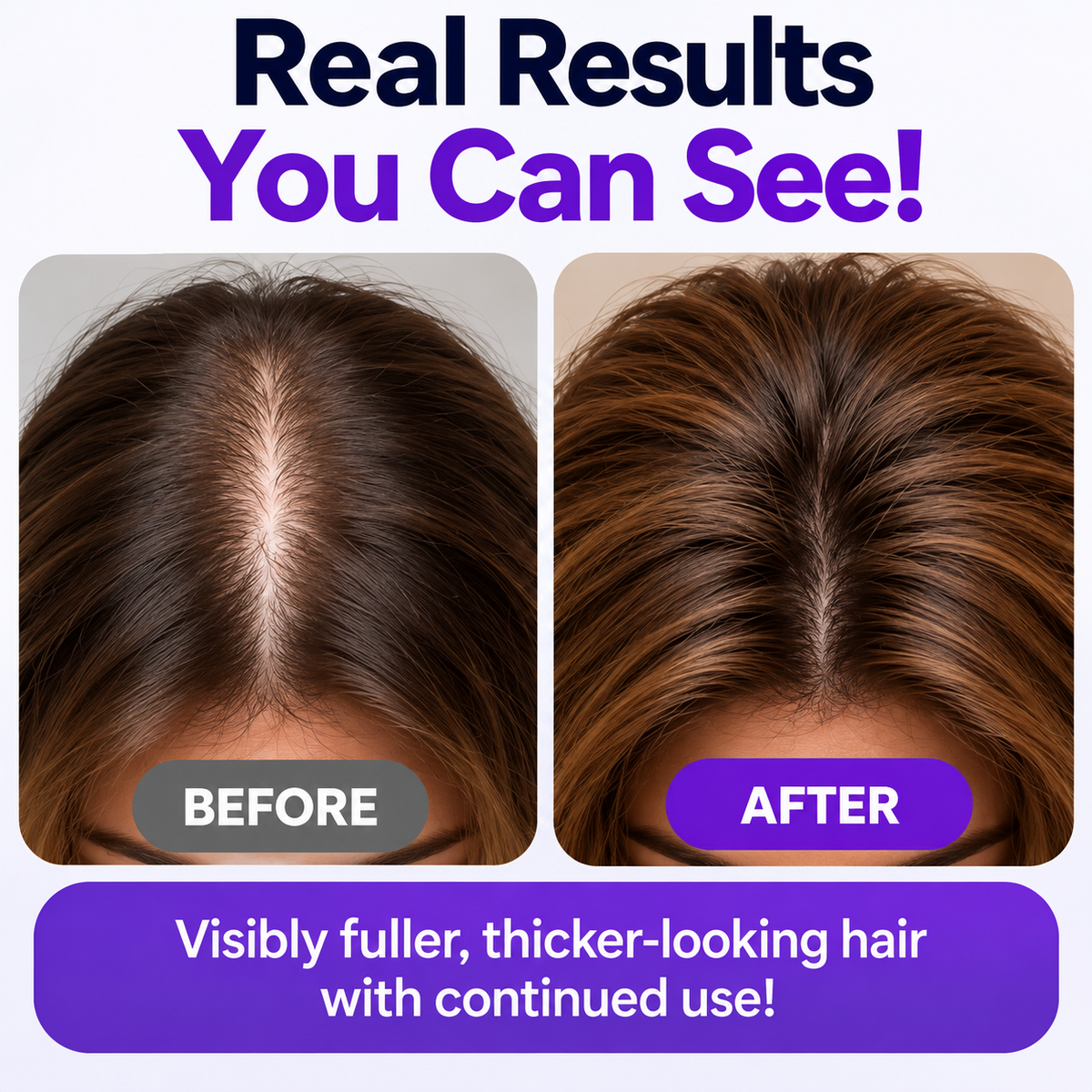 RootBloom™ Rosemary & Rice Water Hair Spray